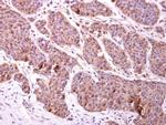 CHMP2B Antibody in Immunohistochemistry (Paraffin) (IHC (P))