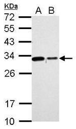 CHMP2B Antibody in Western Blot (WB)