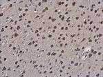 SLIT2 Antibody in Immunohistochemistry (Paraffin) (IHC (P))