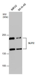 SLIT2 Antibody in Western Blot (WB)