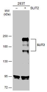 SLIT2 Antibody in Western Blot (WB)