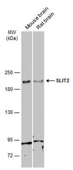 SLIT2 Antibody in Western Blot (WB)