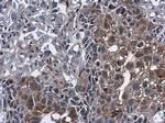 Mig-6 Antibody in Immunohistochemistry (Paraffin) (IHC (P))