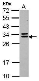 CNOT7 Antibody in Western Blot (WB)