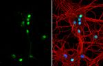 Tenascin R Antibody in Immunocytochemistry (ICC/IF)