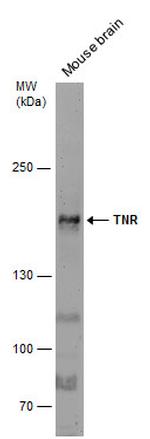 Tenascin R Antibody in Western Blot (WB)