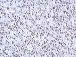 SMNDC1 Antibody in Immunohistochemistry (Paraffin) (IHC (P))