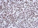 SMNDC1 Antibody in Immunohistochemistry (Paraffin) (IHC (P))