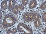 PSD Antibody in Immunohistochemistry (Paraffin) (IHC (P))