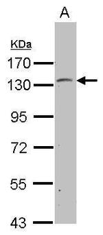 PSD Antibody in Western Blot (WB)