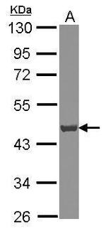 ATP6V0D1 Antibody in Western Blot (WB)