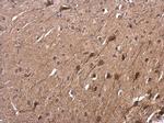 TUB Antibody in Immunohistochemistry (Paraffin) (IHC (P))