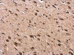 TUB Antibody in Immunohistochemistry (Paraffin) (IHC (P))