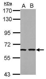 TUB Antibody in Western Blot (WB)