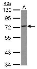 TRIM29 Antibody in Western Blot (WB)