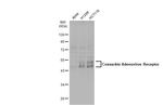 CAR Antibody in Western Blot (WB)