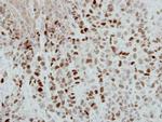 DPPA4 Antibody in Immunohistochemistry (Paraffin) (IHC (P))