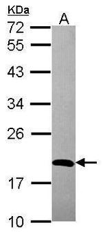 ADI1 Antibody in Western Blot (WB)