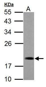 ADI1 Antibody in Western Blot (WB)