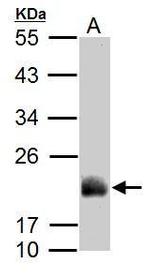 ADI1 Antibody in Western Blot (WB)