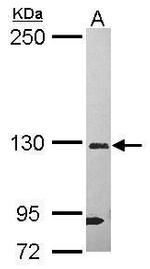 DHX37 Antibody in Western Blot (WB)