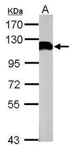 USP13 Antibody in Western Blot (WB)