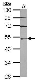 UBA3 Antibody in Western Blot (WB)