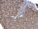 STRAP Antibody in Immunohistochemistry (Paraffin) (IHC (P))