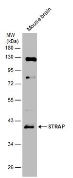 STRAP Antibody in Western Blot (WB)