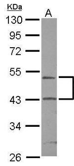 RUNDC3A Antibody in Western Blot (WB)