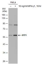 IFIT1 Antibody in Western Blot (WB)