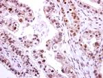 NEK2 Antibody in Immunohistochemistry (Paraffin) (IHC (P))