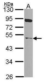 NEK2 Antibody in Western Blot (WB)