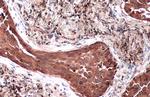 TSG101 Antibody in Immunohistochemistry (Paraffin) (IHC (P))