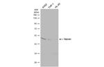 TSG101 Antibody in Western Blot (WB)