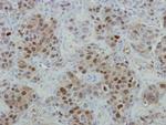 MRE11 Antibody in Immunohistochemistry (Paraffin) (IHC (P))