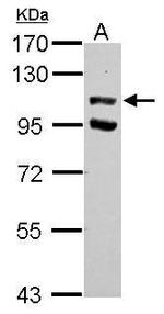 USP37 Antibody in Western Blot (WB)