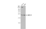 MRPL11 Antibody in Western Blot (WB)