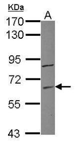 ZNF282 Antibody in Western Blot (WB)