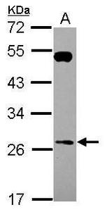 RAB26 Antibody in Western Blot (WB)