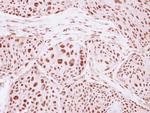 GTF3C4 Antibody in Immunohistochemistry (Paraffin) (IHC (P))