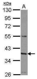 GNA11 Antibody in Western Blot (WB)