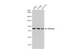 PDE10A Antibody in Western Blot (WB)