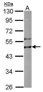 RIPX Antibody in Western Blot (WB)