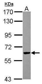 RIPX Antibody in Western Blot (WB)