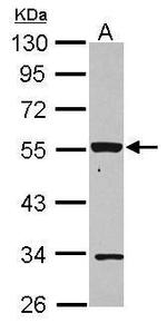 P2X2 Antibody in Western Blot (WB)