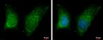 RAB11B Antibody in Immunocytochemistry (ICC/IF)