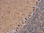 RAB11B Antibody in Immunohistochemistry (Paraffin) (IHC (P))