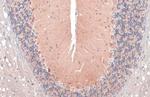 RAB11B Antibody in Immunohistochemistry (Paraffin) (IHC (P))