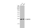 RAB11B Antibody in Western Blot (WB)